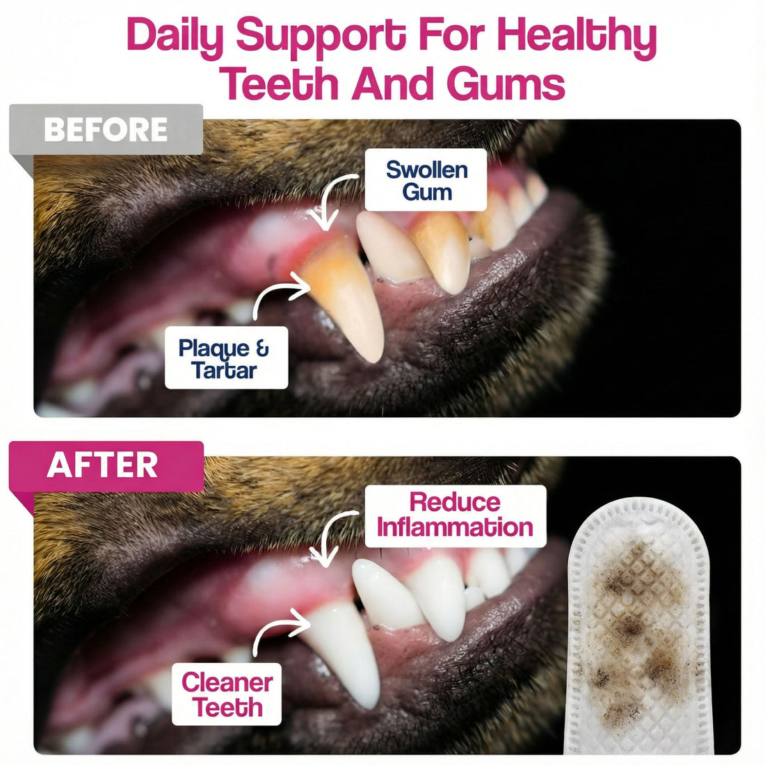 Dental Finger Wipes for Teeth Cleaning (50 Count)